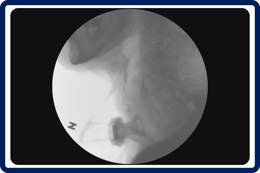 mbs-xray